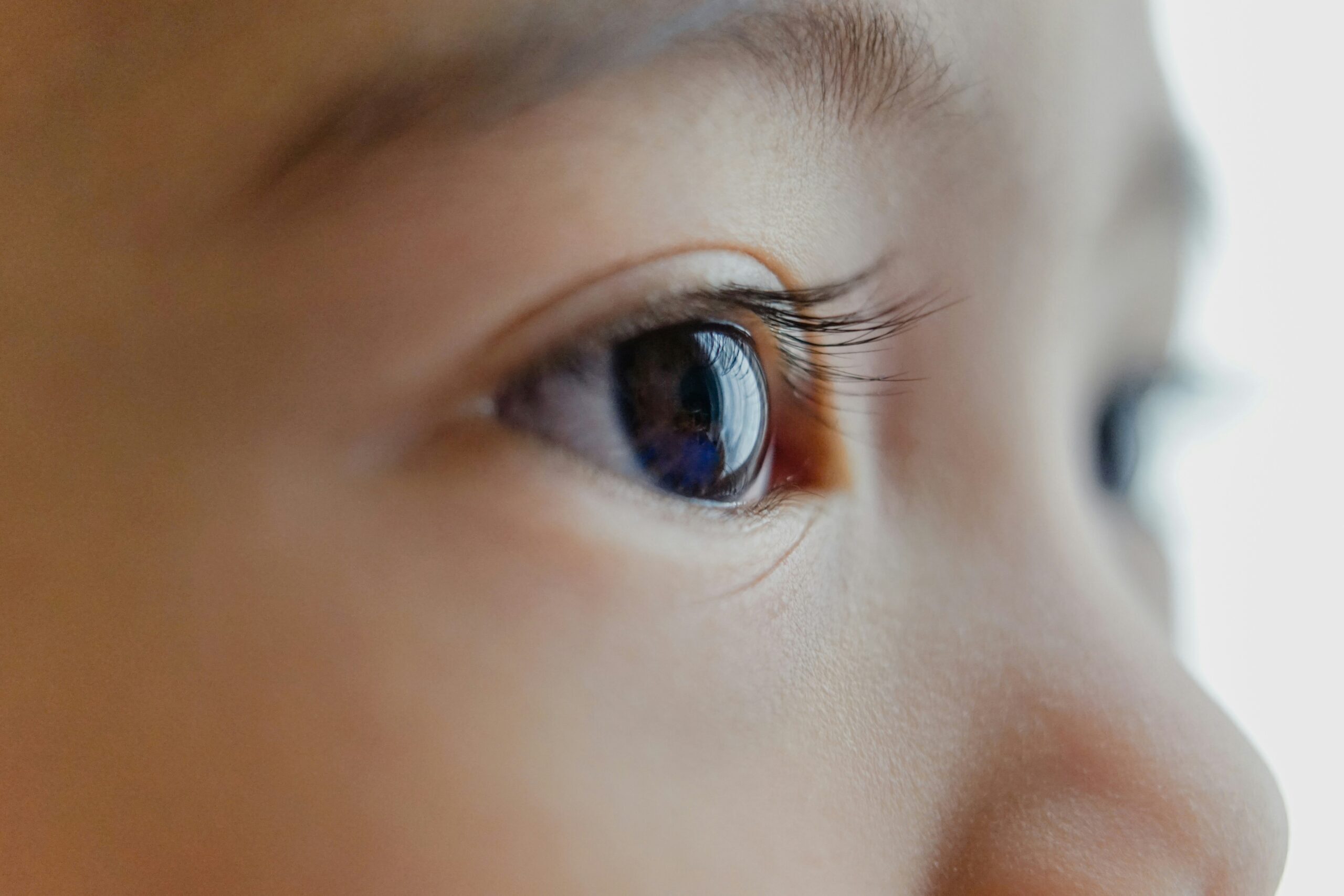 eye-1